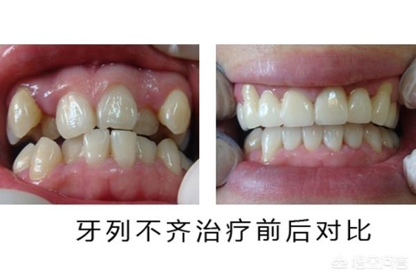 新昌最新24小时牙医在线咨询方法分析(最方便真实的新昌有没有24小时牙医方法)