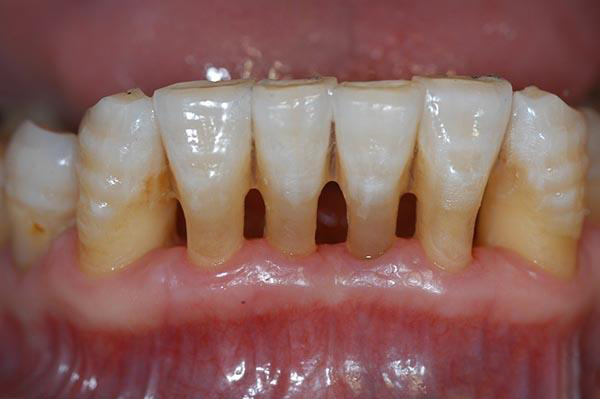 新昌最新24小时牙医在线咨询方法分析(最方便真实的新昌有没有24小时牙医方法)